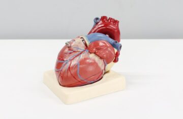 Photo ecg