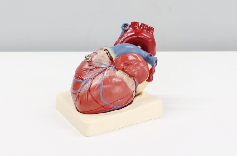 Photo ecg